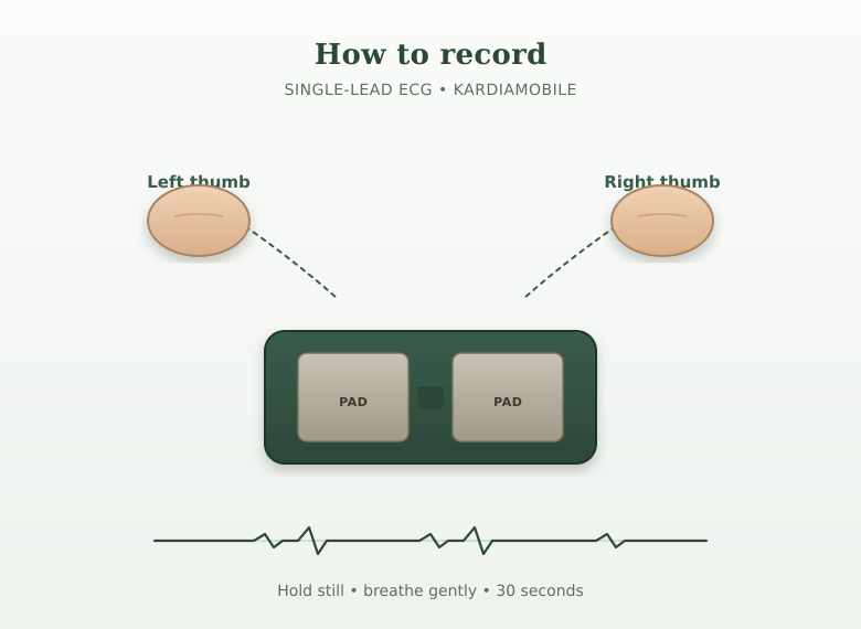 Diagram showing how to record with Kardia: place each thumb on one electrode pad, hold still for 30 seconds, single-lead ECG.